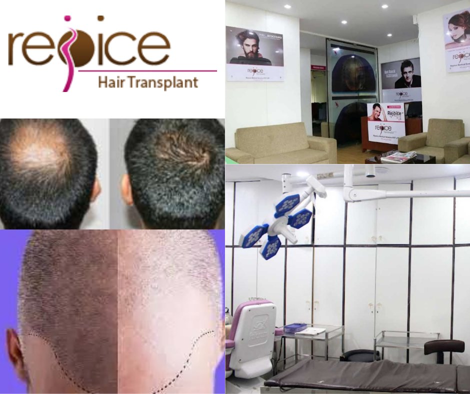 wakad_in's tweet image. Rejoice is one of the Best hair transplant &amp;amp; scalp pigmentation clinic in wakad, Hinjewadi.
Visit: wakad.in/item/hair-tran…
Call us: +91 7774009222

#Hairtransplant #MicroScalpPigmentation #RejoiceClinic #Wakad #Hinjewadi