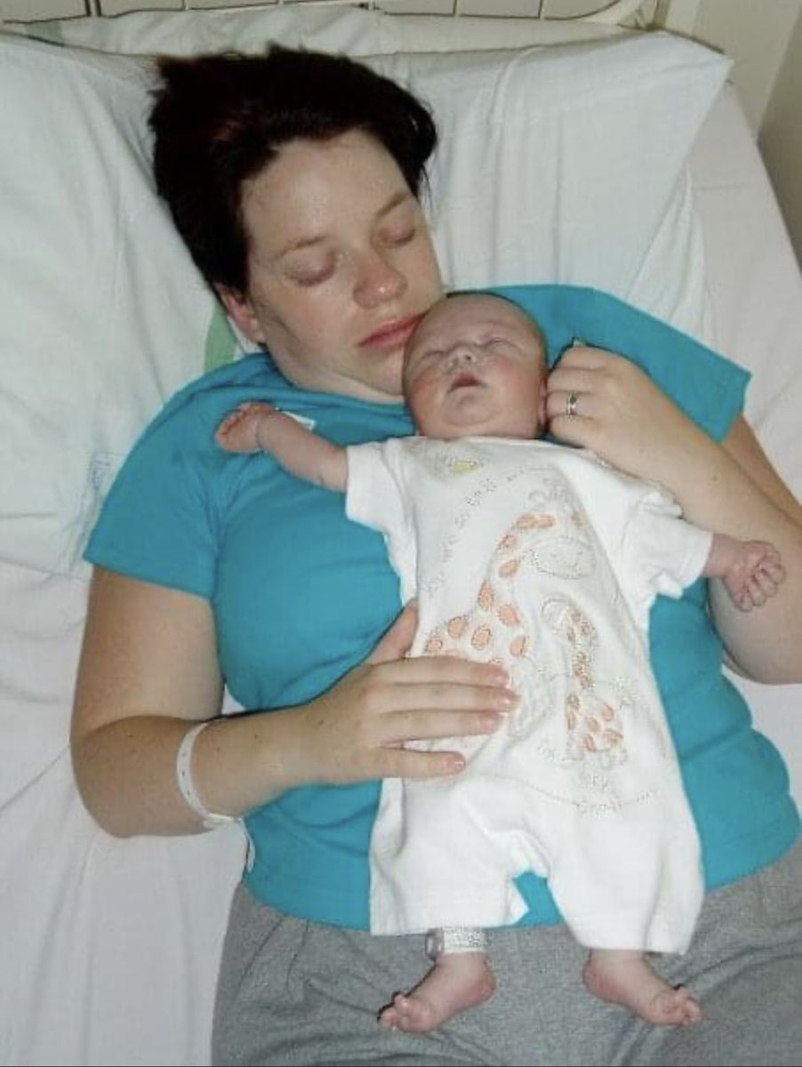 Baby loss awareness week comes to a close and it is so important we keep these conversations happening. Martha was so perfect and the 2 days we had were amazing. I was so lucky to be able to feel her heartbeat as I know not everyone gets that my beautiful girl #babylossawareness