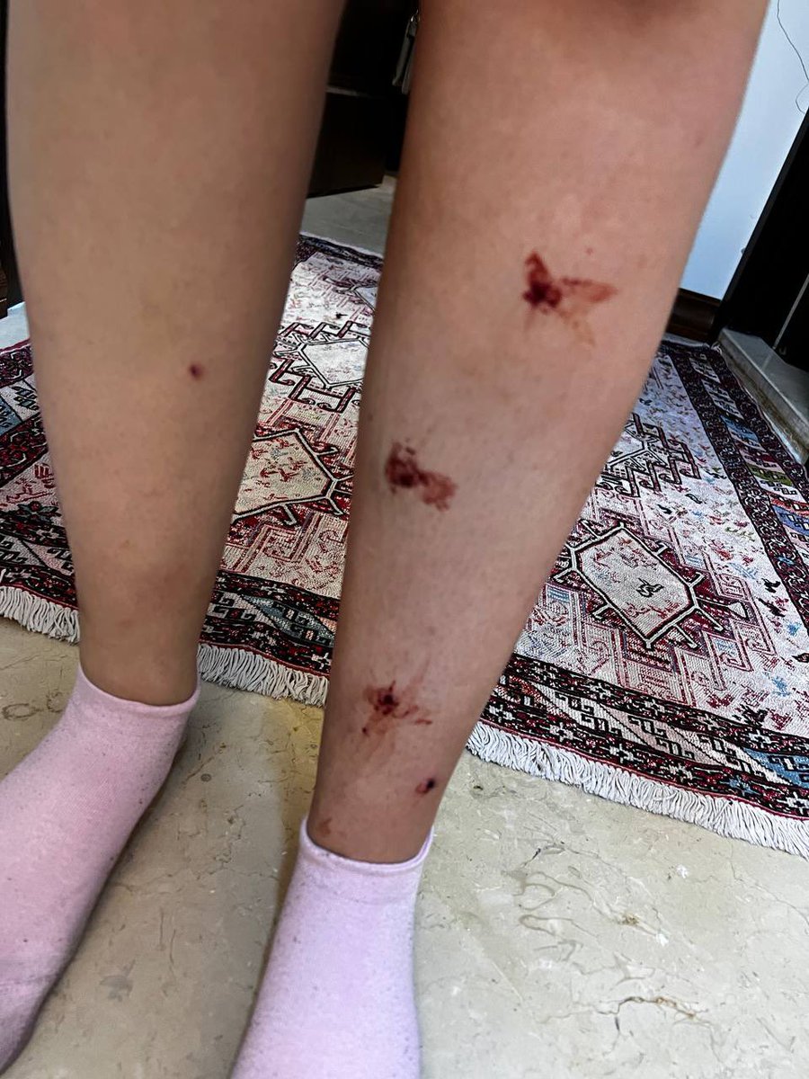 AlinejadMasih's tweet photo. “Regime think by shooting us, we give up our fight. We rather die but not live with humiliation. We will continue to be in the streets until the day that we take Iran back from Islamic regime.”
This is a message from a woman who is in frontline of #IranRevolution.
#MahsaAmini https://t.co/erCcDkPEBr