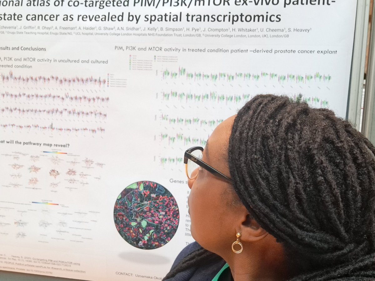 UzoamakaOkoli2's tweet photo. #MAP22 #Esmo #nanostring #pcuk
Come meet us at 99p and 120p, let's discuss the first study ever done to unveil spatially resolved  transcriptomics of unique prostate cancer explants and targeted Therapies . https://t.co/L567NIN3L5