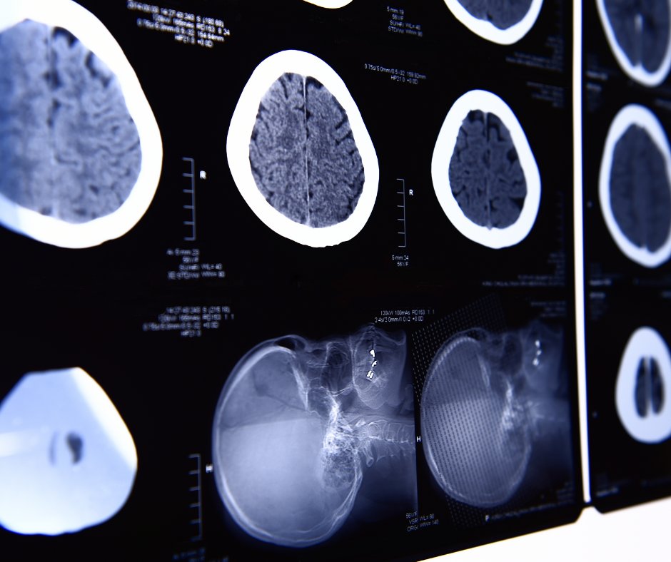 GE Healthcare Announces Moves to Bolster Supple of Iodinated Contrast Media for #CT and #XRay Imaging ow.ly/FXwK50LaTiY @ACRRFS @ACRYPS @RadiologyACR @ARRS_Radiology @RSNA @GEHealthcare @PennRadiology @UABRadiology @JeffersonRads @MontefioreRAD @WCMRadiology #radiology