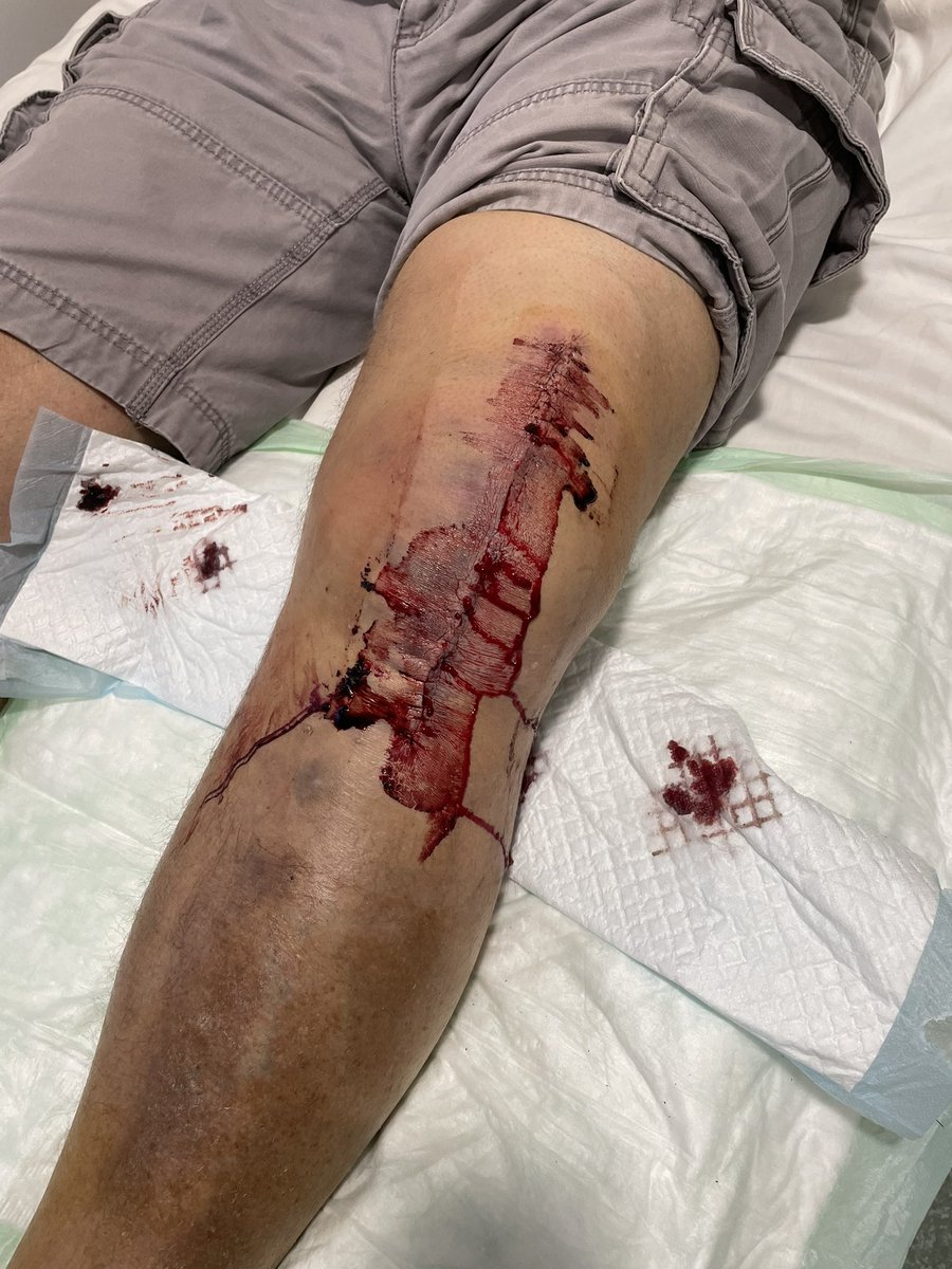 BeefyBotham tweet media