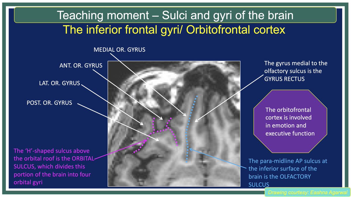 MohitAgNeurorad tweet picture