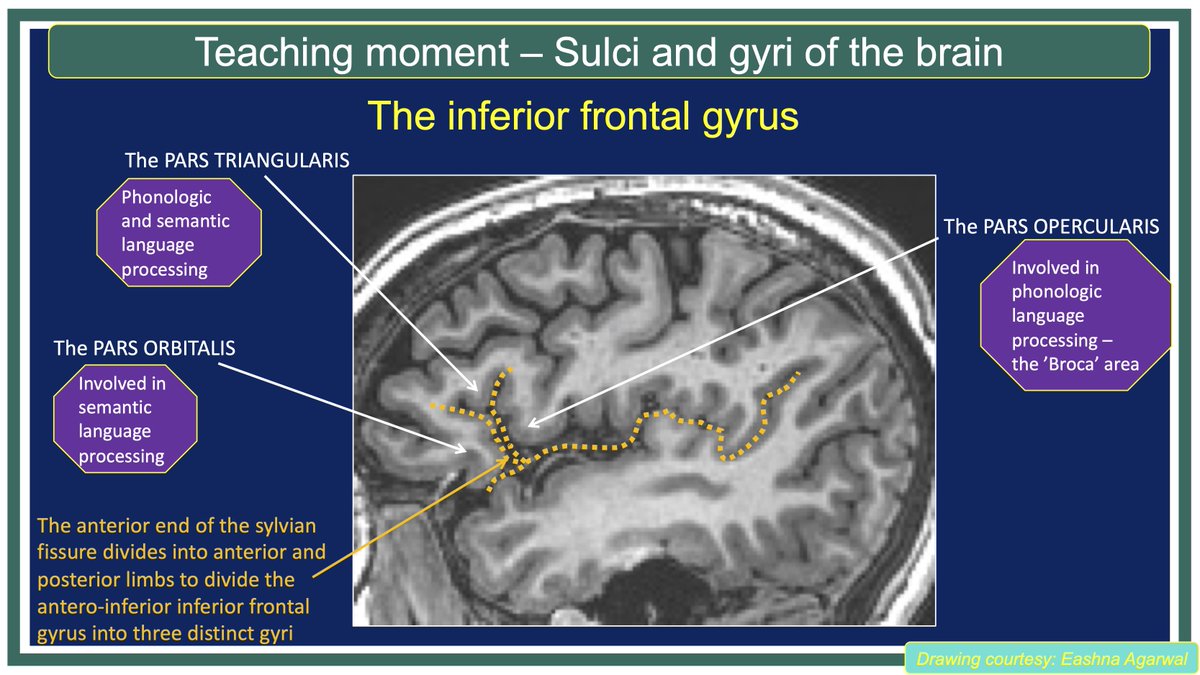 MohitAgNeurorad tweet picture