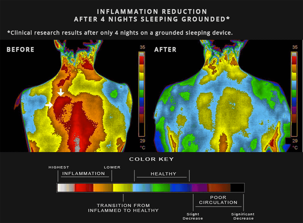 Helios_Movement's tweet photo. Reminder: Grounding is completely free and one of the most effective anti inflammatories that exists. https://t.co/dgoy57zK6e