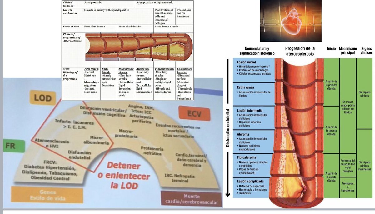ana_apiecar's tweet photo. Cuando diagnosticamos a alguien de DM2 yo les digo que no se preocupen, sobretodo si diagnosticamos precozmente, pq gracias a ello vamos a poder realizar tratamientos que de otra manera quizás no pudiéramos,y todo ello nos ayudará a frenar, incluso revertir #continuumCV ▶️#AEllo https://t.co/UPWBdNKog5