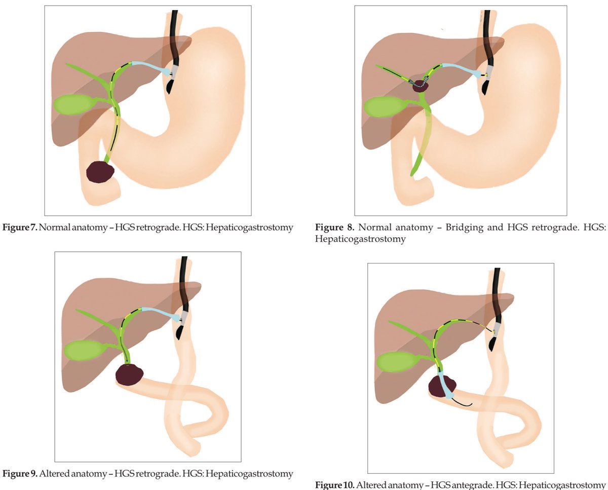 EUS & ERCP Master tweet media