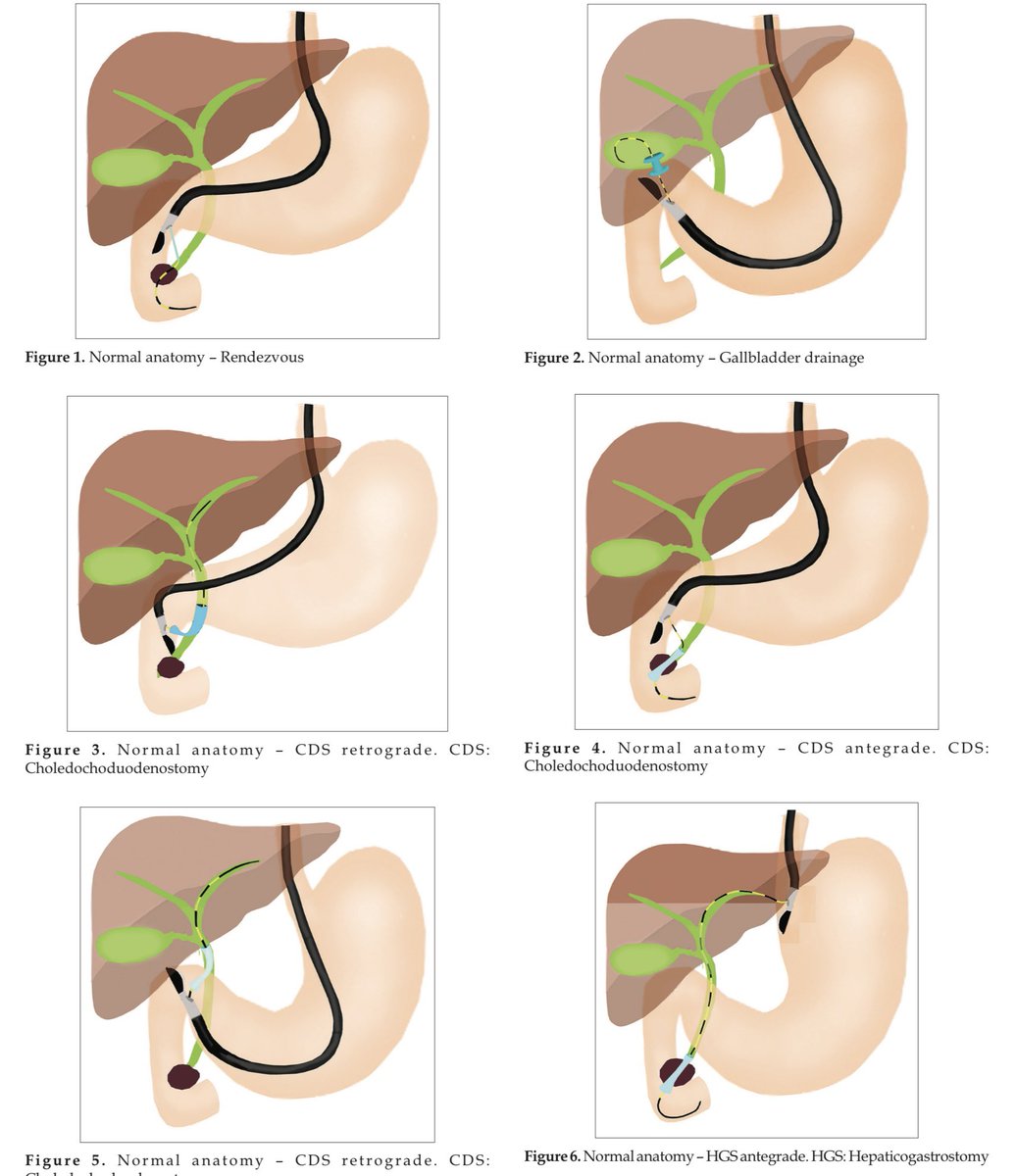 EUS & ERCP Master tweet media