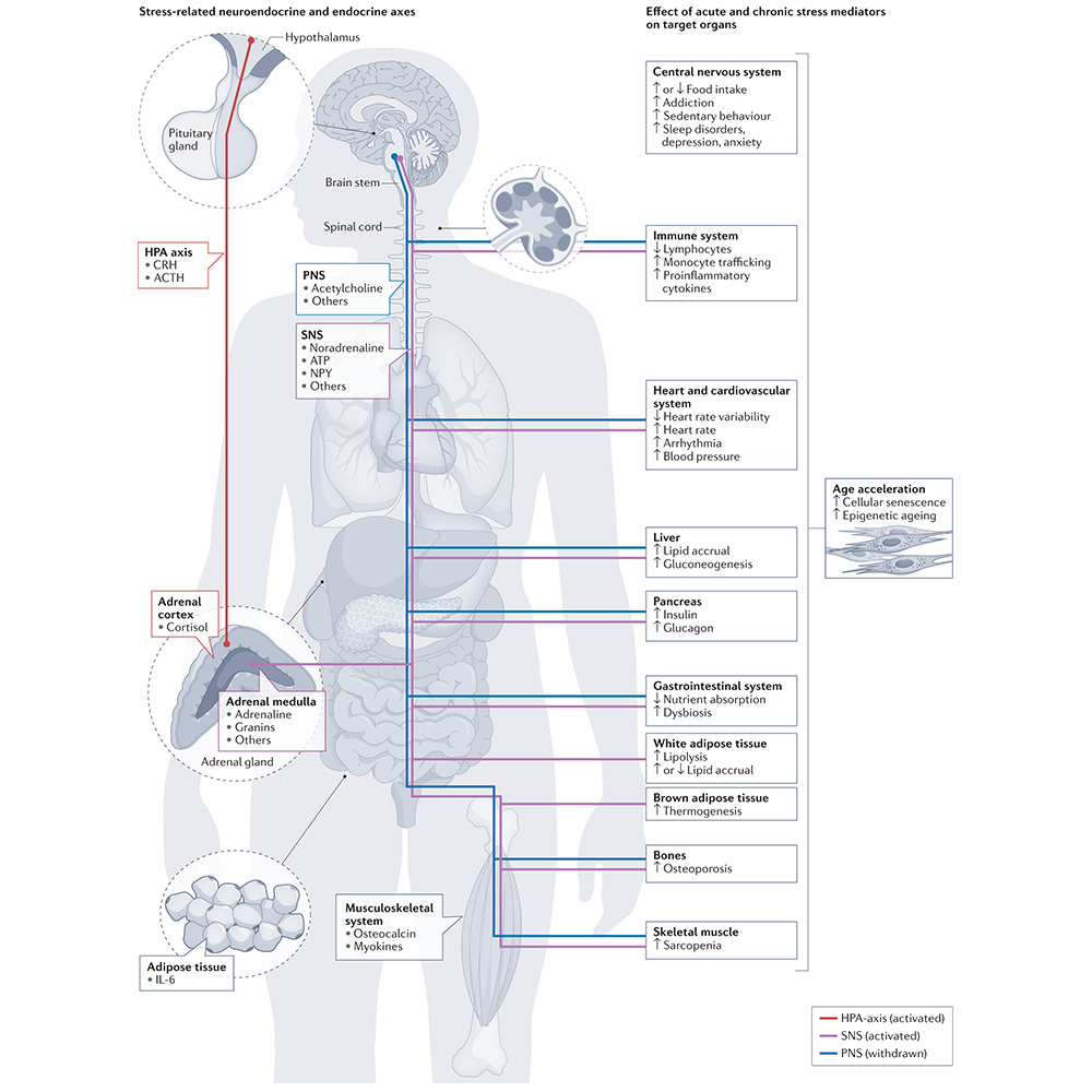 Nature Portfolio (@natureportfolio) on Twitter photo This Review, published in <a href="/NatureRevEndo/">Nature Reviews Endocrinology</a>, discusses the pathophysiological mechanisms underlying the association between stress and metabolic disease, and evaluates the epidemiological evidence for the influence of stress on metabolic disease. go.nature.com/3CYmPxN This Review, published in <a href="/NatureRevEndo/">Nature Reviews Endocrinology</a>, discusses the pathophysiological mechanisms underlying the association between stress and metabolic disease, and evaluates the epidemiological evidence for the influence of stress on metabolic disease. go.nature.com/3CYmPxN