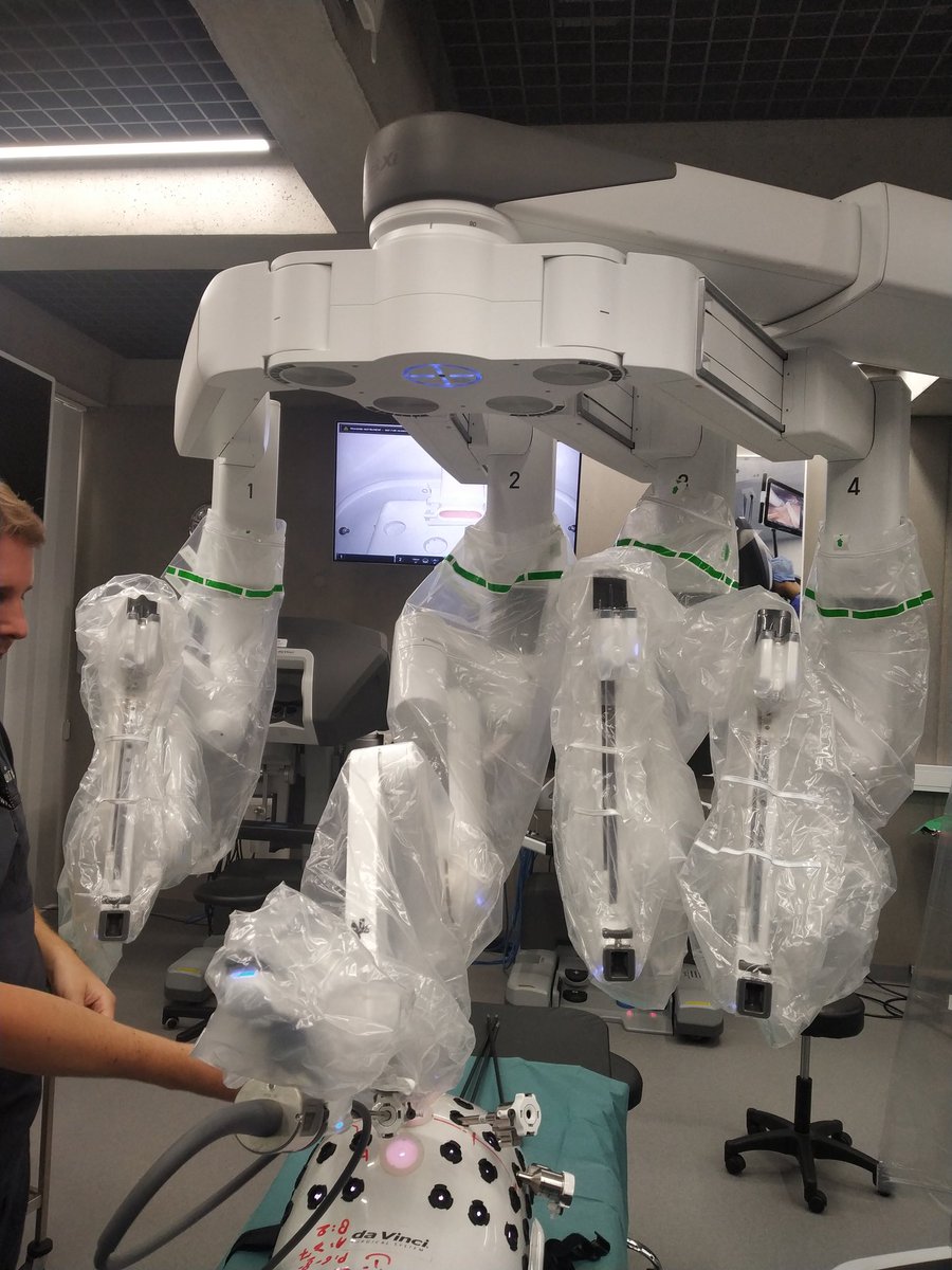Dharmender Aggarwal (@dharmender8888) on Twitter photo A beautiful experience at The ORSI academy and city of Ghent for EAU-ERUS Robotic Surgery Course.
Thanks for my host centre St George's Hospital <a href="/GeorgesUrology/">St George's Urology</a> to arrange this. <a href="/HARQazi/">Hasan Qazi</a> <a href="/roboturologist/">Christopher Anderson</a> <a href="/Issarami/">Rami Issa</a> <a href="/DenosshanSri/">Denosshan Sri</a> <a href="/PieterleRoux20/">Pieter le Roux</a> <a href="/PaoloUmari/">Paolo Umari</a> G8 work by <a href="/orsiacademy/">Orsi Academy</a>. A beautiful experience at The ORSI academy and city of Ghent for EAU-ERUS Robotic Surgery Course.
Thanks for my host centre St George's Hospital <a href="/GeorgesUrology/">St George's Urology</a> to arrange this. <a href="/HARQazi/">Hasan Qazi</a> <a href="/roboturologist/">Christopher Anderson</a> <a href="/Issarami/">Rami Issa</a> <a href="/DenosshanSri/">Denosshan Sri</a> <a href="/PieterleRoux20/">Pieter le Roux</a> <a href="/PaoloUmari/">Paolo Umari</a> G8 work by <a href="/orsiacademy/">Orsi Academy</a>.