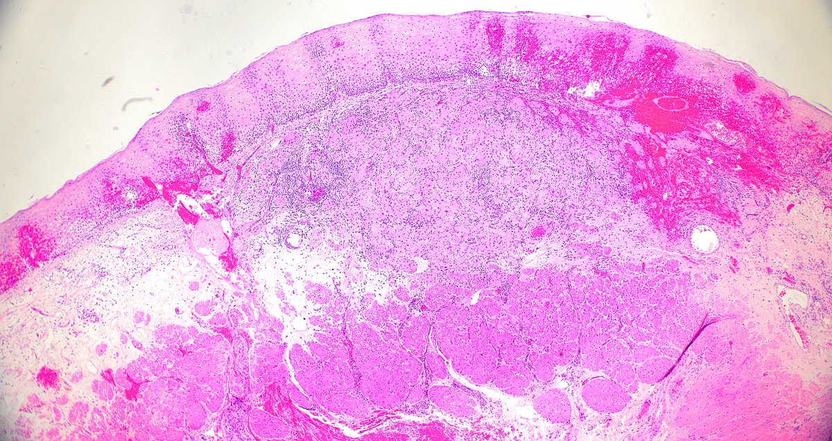 Hopkins GI Pathology tweet media