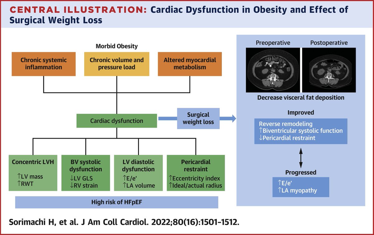 AbeytuaManuel's tweet photo. Long-Term Changes in Cardiac Structure and Function Following #BariatricSurgery (BS).-
JACC 2022;80:1501-1512
After BS was epicardial fat reduction, Left Ventric reverse remodeling, and improved longitudinal biventricular, but Left Atrial myopathy and congestion still progressed. https://t.co/uzbMRCNpdu