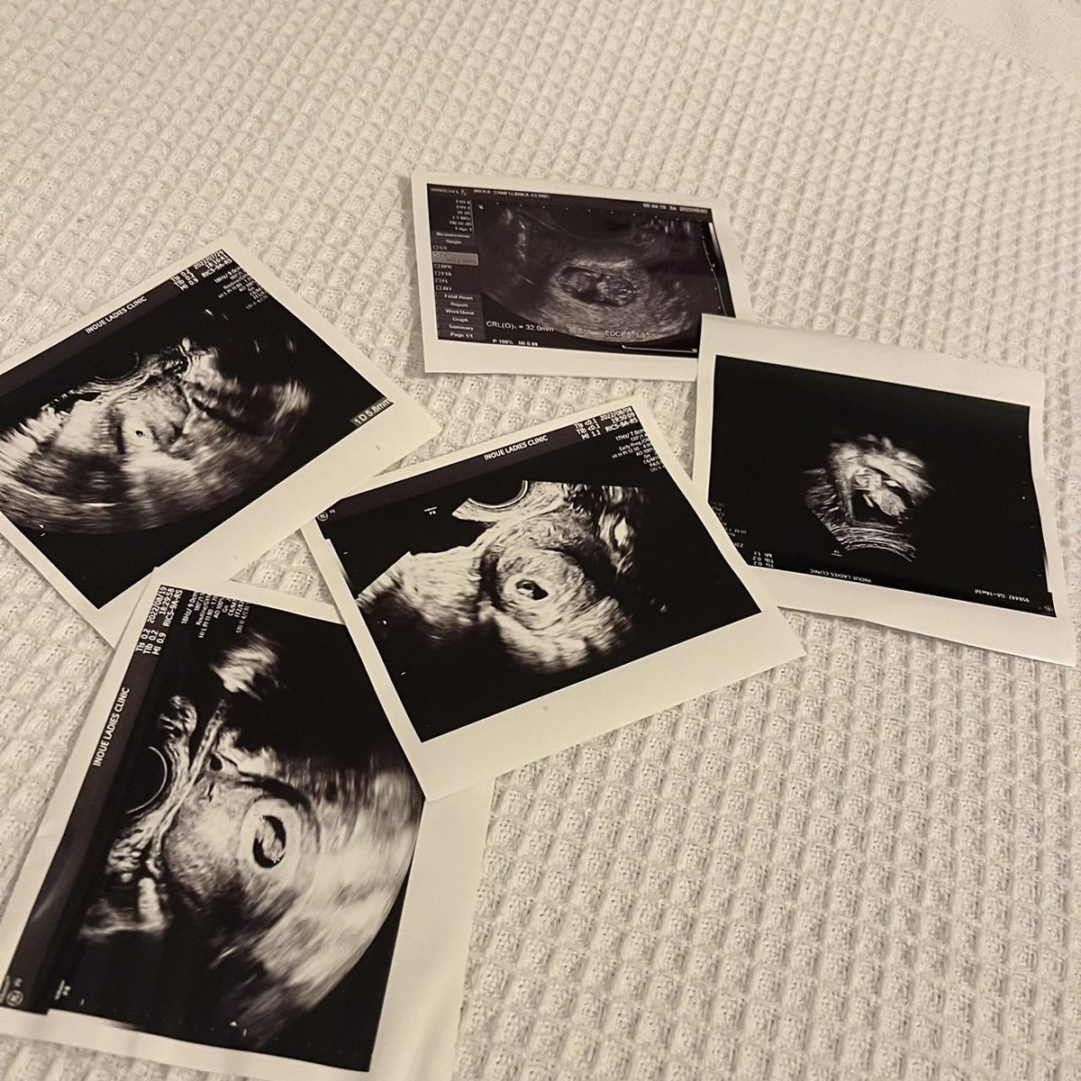 ShoyaSh's tweet photo. 10月10日入籍しました🙇‍♂️
子供できたしがんばれる🫶

これからもよろしく🫶👶👩 https://t.co/dirFZnVZIi