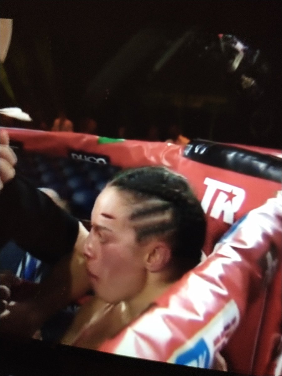 thinkboxing_'s tweet image. Big cut in this Aus vs Aus. Better boxer Johnson has massive cut over eye. Has kd Ramadan since the cut and R has lost a point due back of the head antics #HaneyvKambosos