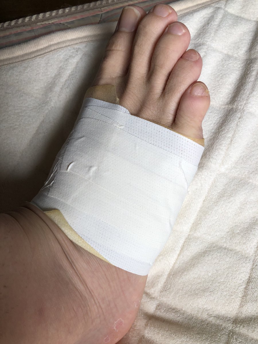 テーピングも手早くできるようになったもんだ 