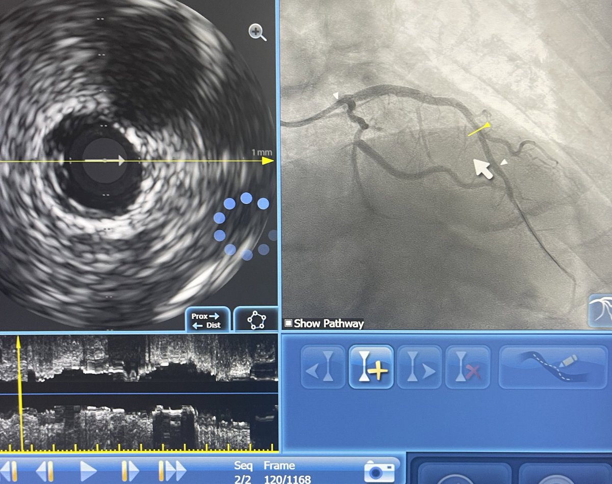 Dallas PCI (@dallas_pci) on Twitter photo First Interventional Fellows Course here in Dallas,TX on November 11th! Scholarships available to cover travel and accomodation. Available for current Interventional and 3rd year cardiology fellows heading into IC. Email: info@thefacet.org now! Go to dallaspci.com First Interventional Fellows Course here in Dallas,TX on November 11th! Scholarships available to cover travel and accomodation. Available for current Interventional and 3rd year cardiology fellows heading into IC. Email: info@thefacet.org now! Go to dallaspci.com