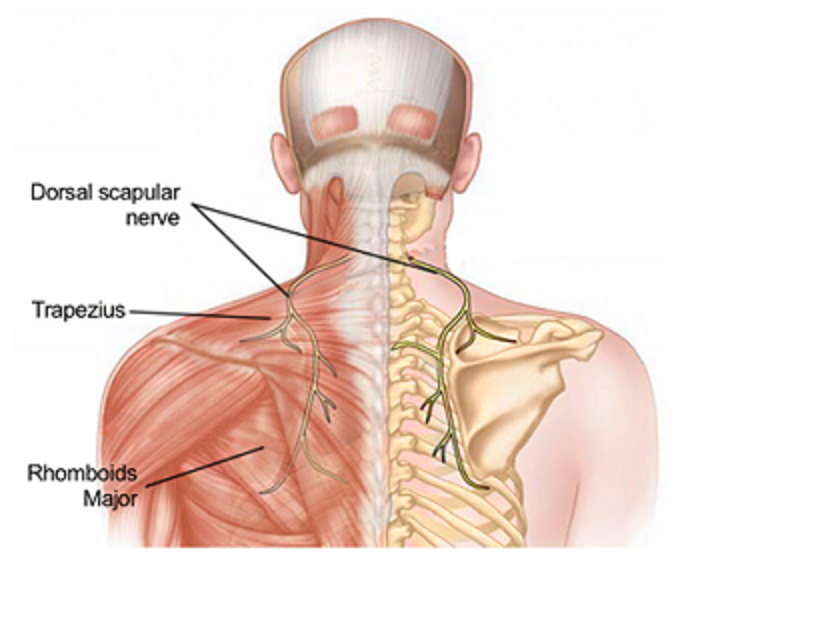 drdozellodc's tweet photo. Dorsal Scapular Nerve Entrapment
Dr Donald A Ozello DC of Championship Chiropractic
#vegas #chiropractor #chiropractic #sportsmedicine #dorsalscapularnerve #dorsalscapularnerveentrapment #rhomboids #levatorscapula https://t.co/1Ona3LmnZo https://t.co/1IVIa3puBl