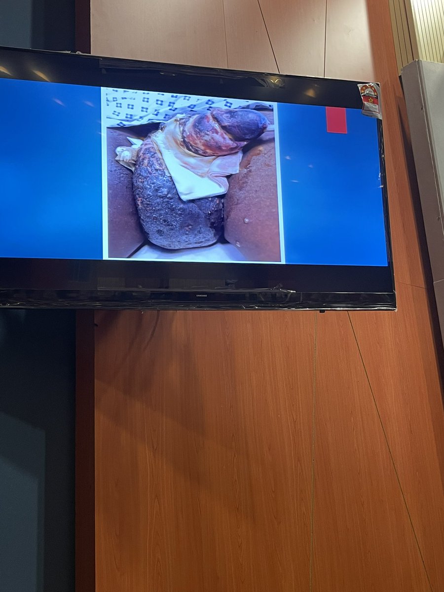 fshaffik's tweet photo. monkeypox can spread through sex

pakai lah kondom ya 
safe sex!

kalau tak jd mcmni https://t.co/I22ftiHdtL