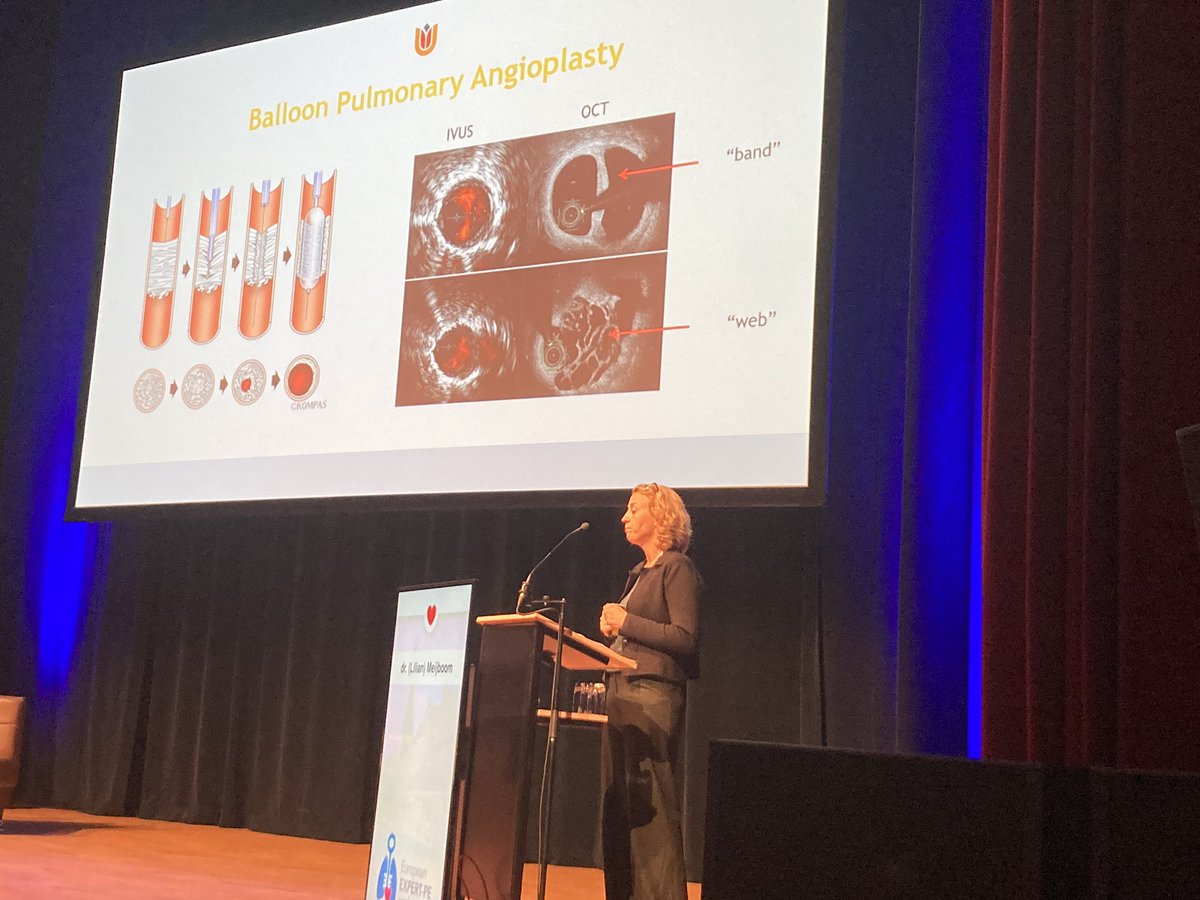 Erik Klok (@erik_klok_md) on Twitter photo <a href="/LilianMeijboom/">lilian meijboom</a> showing us novel treatment approaches for CTEPD with/without PH. We should be at high alert to identify these patients early #expert_pe2022 <a href="/LilianMeijboom/">lilian meijboom</a> showing us novel treatment approaches for CTEPD with/without PH. We should be at high alert to identify these patients early #expert_pe2022