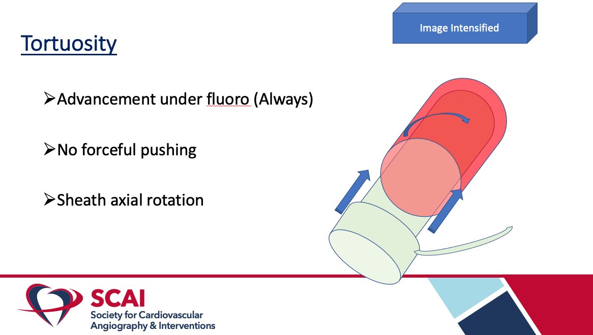 HadyLichaaMD's tweet image. #CathTips on #LargeBoreAccess &amp;amp; #DryClosure

@SukhNijjer @kerrigjl @sbrugaletta @AGoldsweig @behnam_tehrani @NavinKapur4 @adityadoc1 @prkothapalli @monteleoneMD @DrSethdb @timir_paul @KardiologieHH @PCRonline @GoranEBC @DocSavageTJU @jaygirimd @georgedangas @ArasiMaran @ekgpdx