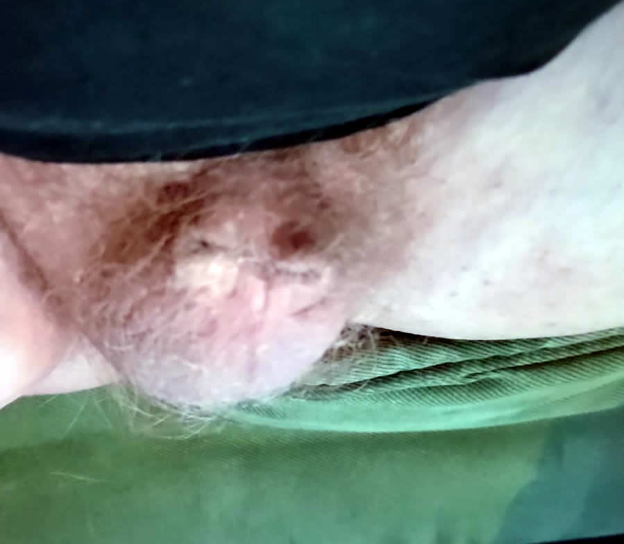 dcbbslave's tweet photo. Temporary Penectomy to take Locktober to the next level https://t.co/8PXPMQfmbO