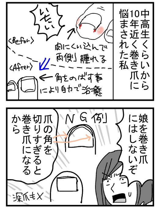 ムーコ3歳の時の漫画。
今のムーコは足の爪も硬くなったけど、ナナオはこんな感じになってる。
(足の爪が欠ける場合は、靴が小さい場合があるそうです)
#育児漫画 #3歳 