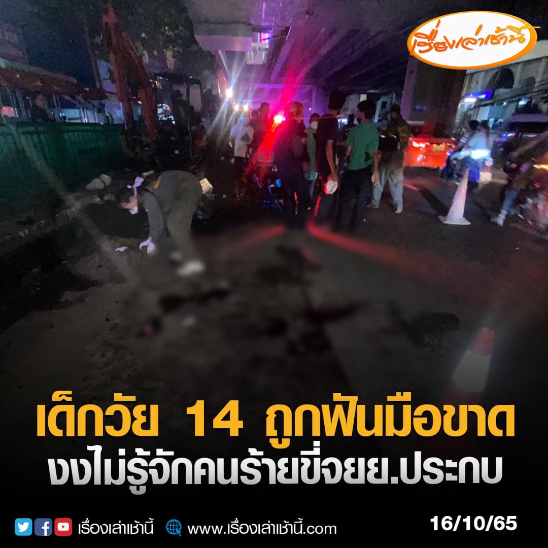 อีสัส ประเทศกูบ้านป่าเมืองเถื่อนชิบหาย น้องเขาเสียมือไปก็เพราะมึง เอากลับมาเหมือนเดิมไม่ได้แล้ว ทำไมเหี้ยขนาดนี้วะ!!!!!