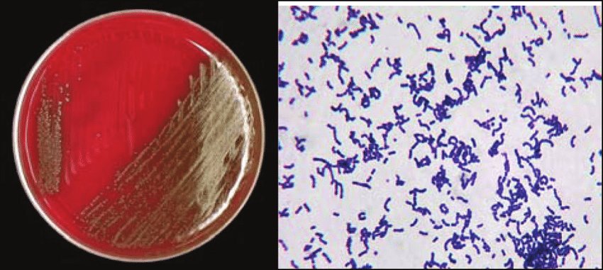 Streptococcus anginosus (formerly milleri) group • 3 species: S.anginosus, S.constellatus, S.intermedius • Colonize oral cavity/GI/GU tract • Prone to cause abscesses incl brain, esp S.intermedius • Tiny colonies with butterscotch/caramel odor • Usually penicillin-S