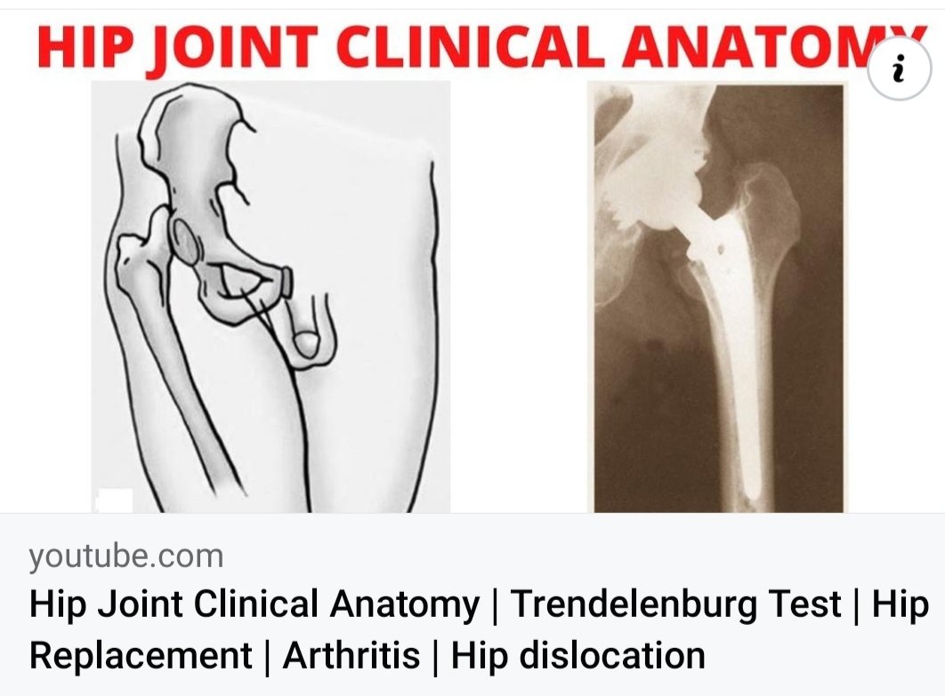 SaqibMansoor16's tweet photo. It feels so good for another accomplishment of mine. The work on Hip Joint is complete, second video uploaded on YouTube. It is Clinical Anatomy of Hip Joint. Kindly support by watching and subscribing.
#anatomy #hipjoint #hipreplacement #hiparthritis #hippain #hipdislocation https://t.co/vVxzRSN8IB