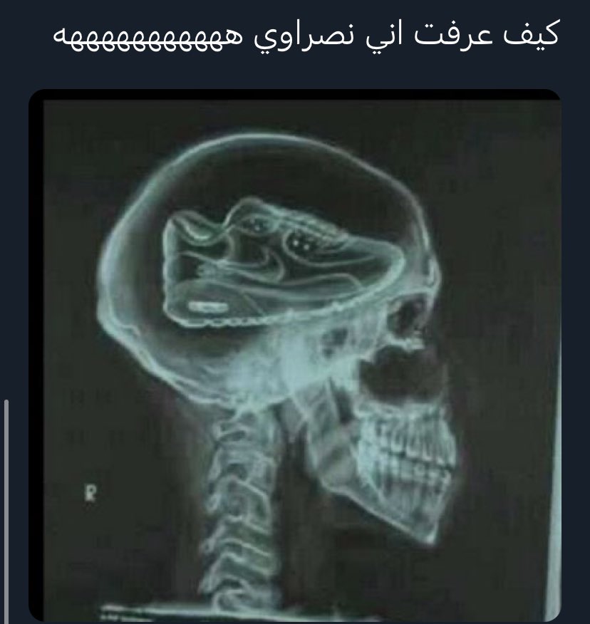 kmfkmf's tweet photo. لا كذا كثير وربي كثير ماهذه العقول يا رب ، رحمتك يا رب . 🫣🫣🫣🫣 https://t.co/19vSt1YKCF