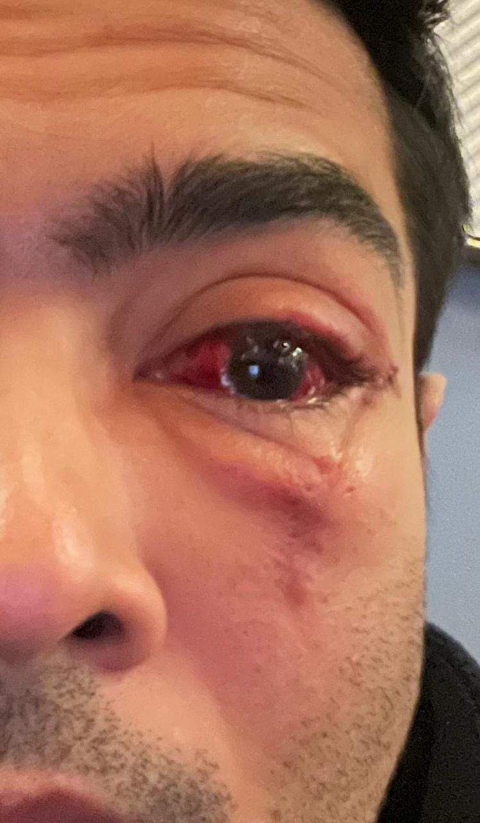 Sukdevc95's tweet image. Get will soon &amp;amp; back to field dada we are waiting for u @abhishekaitc