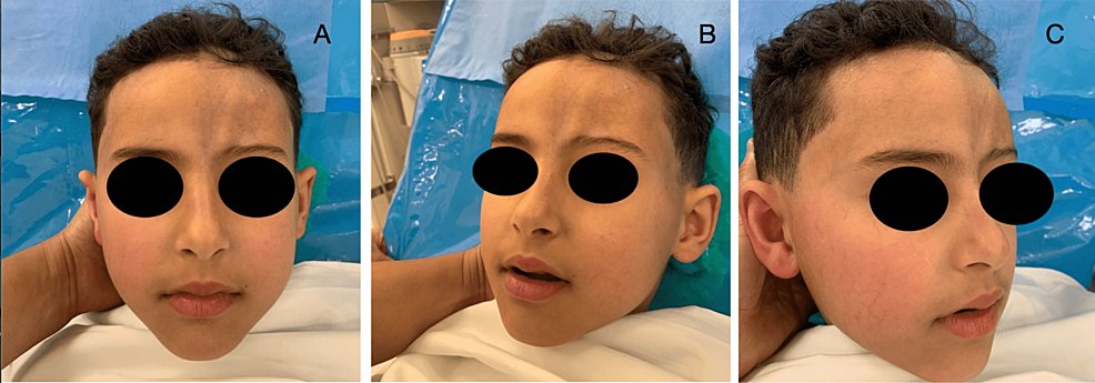 Cureus Dermatology tweet media