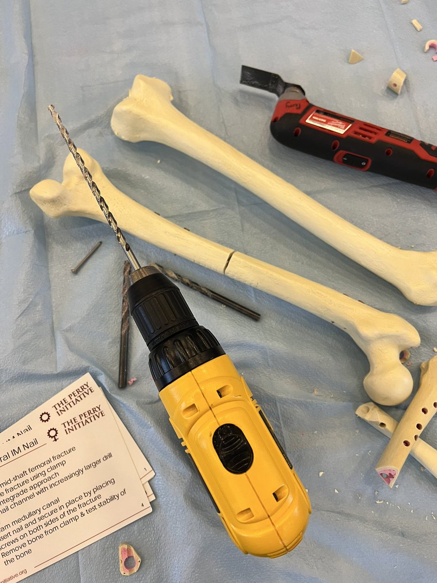 apmeyer11's tweet photo. What better way to spend a Sunday than teaching medical students about femoral nails? Thanks @PerryInitiative for a great event! #womeninortho #orthotwitter https://t.co/IdhGg1Eb5p