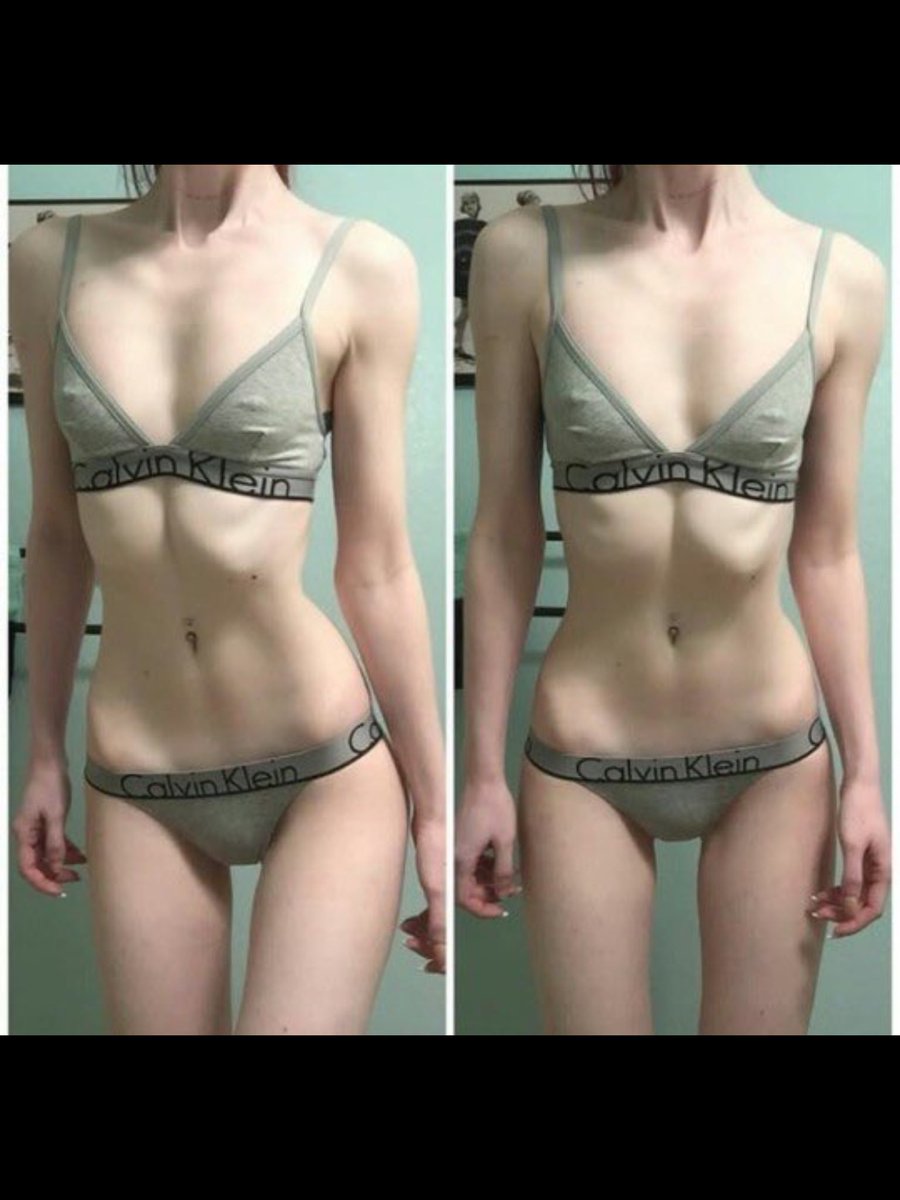 lilah40667513's tweet photo. triggering thinspo from my my hidden album (not me 👎🏼)
#edtwt #notpro #ana #skinnyspo #thin https://t.co/MjQbNbKyrN