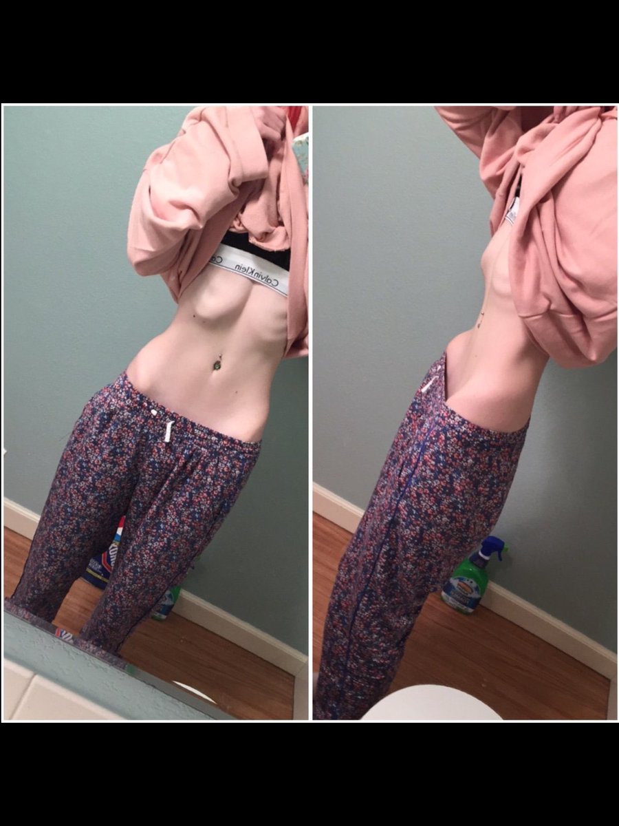 lilah40667513's tweet photo. triggering thinspo from my my hidden album (not me 👎🏼)
#edtwt #notpro #ana #skinnyspo #thin https://t.co/MjQbNbKyrN
