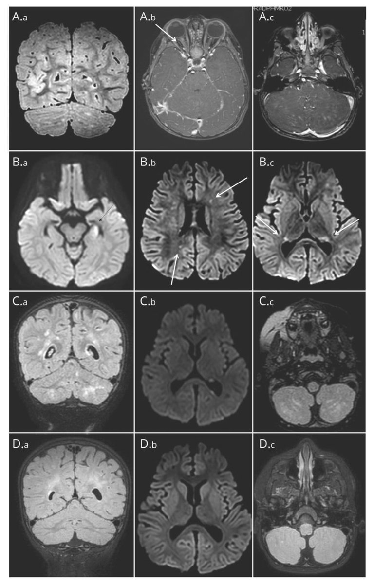 Neurology Journal tweet media