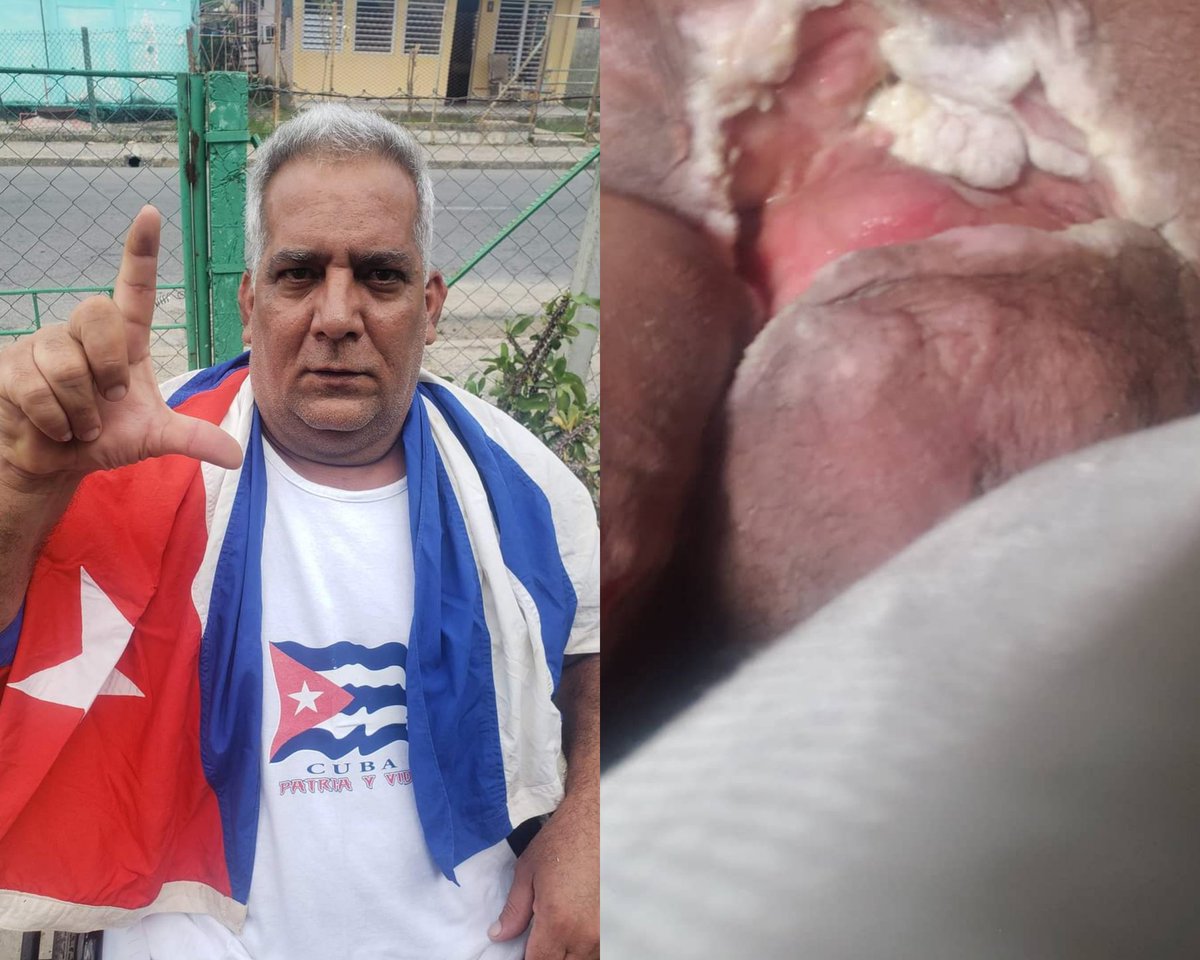 LibreYasmani's tweet photo. Señores necesito que se comparta esto el hermano Julio César  mañana será ingresado en el hospital por qué ya su condición es demaciado grave y puede perder su vida ...todos sabemos lo que le hacen a los opositores en los hospitales cubanos ...comparte por favor 🙏🙏🙏 https://t.co/P1DJ76kg8b