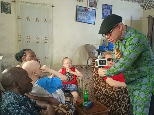ProudlyAlbinism's tweet photo. Thanks to the family of Engr. Solomon Ugorji for having us. It was such a happy moment. Thanks to Human Race Diagnostic and Specialist Huspital for the continues support. We pray for blessings and increase in all your endeavors.
To support our charity work kindly call 07011008096 https://t.co/FwtfUFT9sX