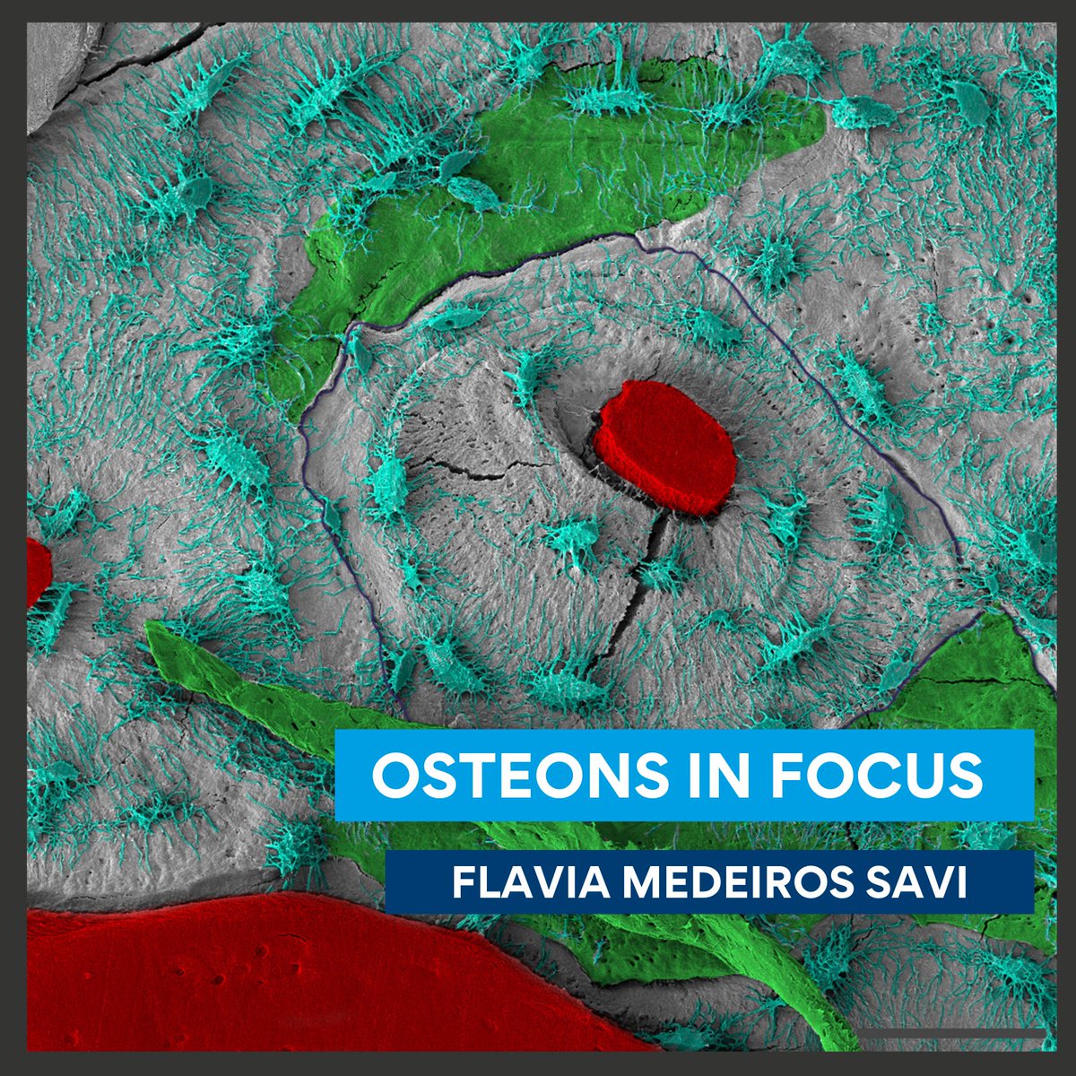 The image shows the new bone tissue being built, and the osteocyte network distributed around the haversian canal. #QUTEngineering #QUTResearch #QUTResearchInFocus