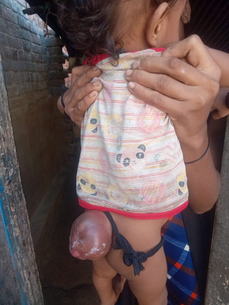 imrahulraiinc's tweet photo. This child is admitted for his surgery in BHU hospital &amp; his parents need financial help for medical expenses. Kindly donte for him what ever amount possible @myogiadityanath 
VR Foundation Trust 
Union bank of India 
A/C No -   363001010032186
IFSC - UBIN0536300  @SonuSood https://t.co/OSZttJzNhu