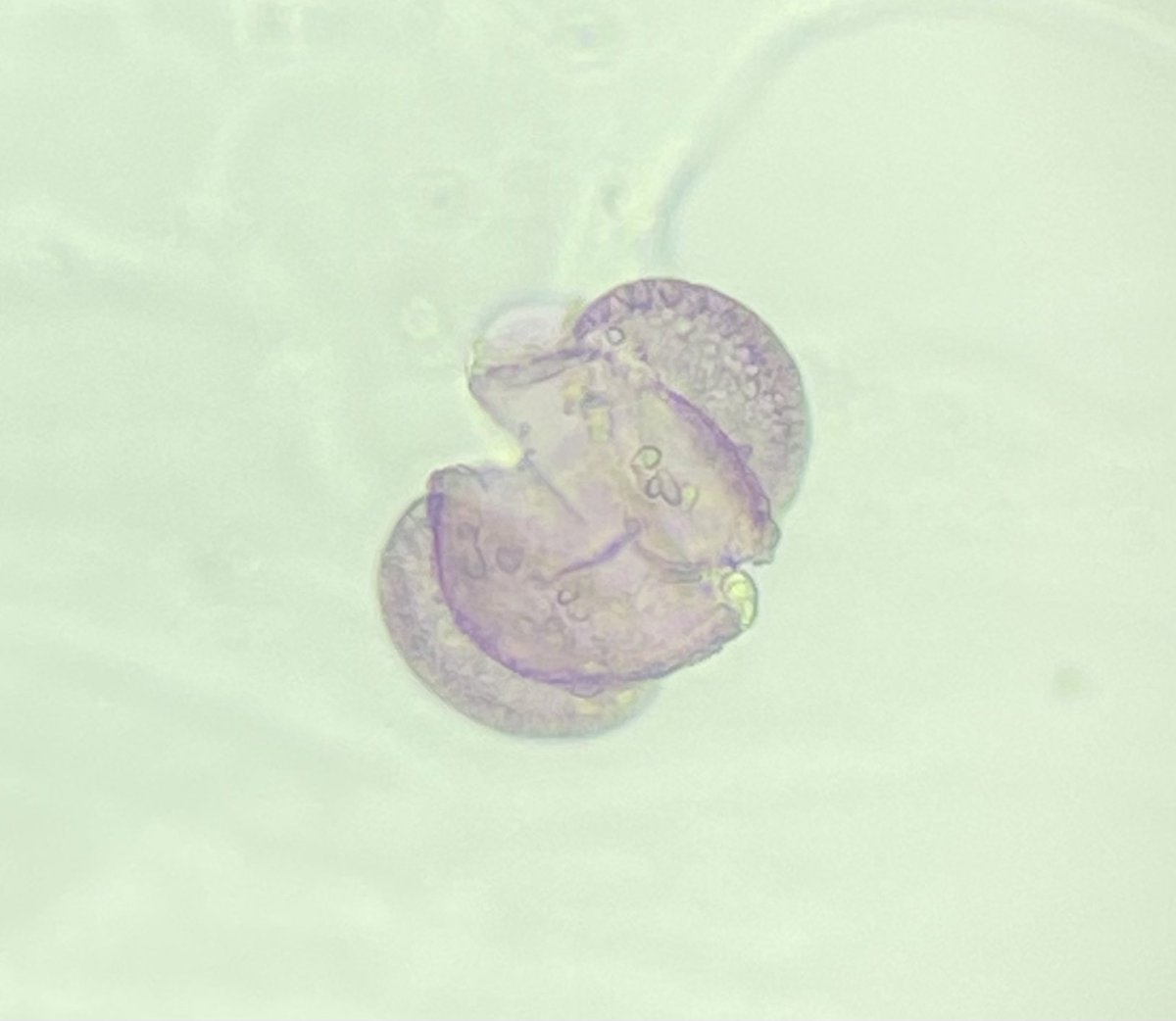 AirRaterUTAS's tweet photo. 💥 A number of pine pollen grains seen at the Hobart lab today were split open! To learn more about pine pollen, visit: https://t.co/934RFcUi7o #pollen 🔬 https://t.co/RYahDrMP7W