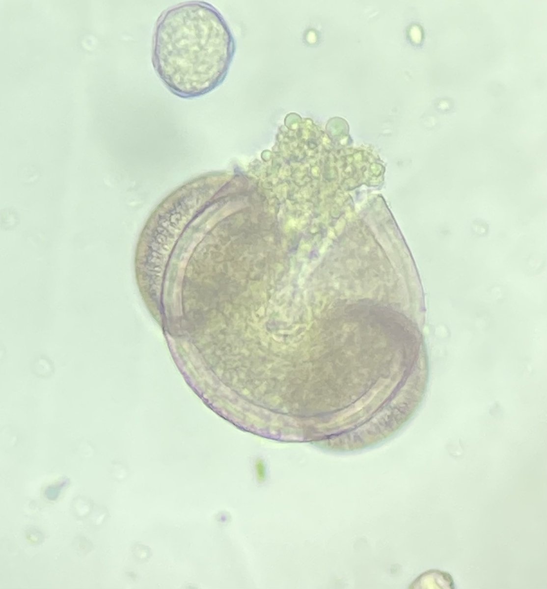 AirRaterUTAS's tweet photo. 💥 A number of pine pollen grains seen at the Hobart lab today were split open! To learn more about pine pollen, visit: https://t.co/934RFcUi7o #pollen 🔬 https://t.co/RYahDrMP7W