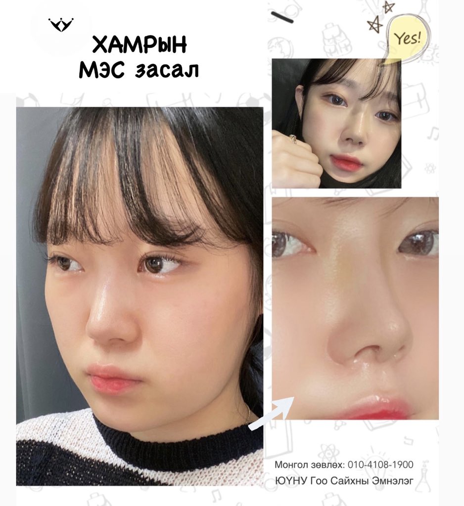 Yuno.Mongolia (@MongoliaYuno) / Posts / X
