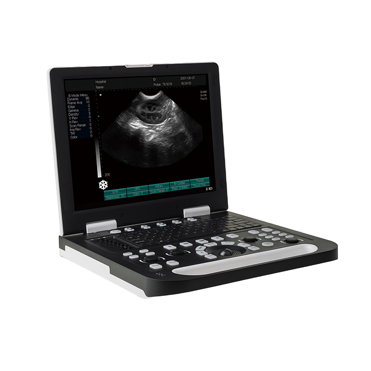 EasonShan1's tweet photo. Animal handheld full digital laptop veterinary portable ultrasound scanner machine on https://t.co/BpOOin7QmA
#tradefair  #fair #onlineexhibition  #matchupexpo #phygitalevents #hybridevents #exhibition #onlinevendorevent #digitalevent  #o2o #o2oexhibition  #matchmarket #scanner https://t.co/WgXxh7GexL