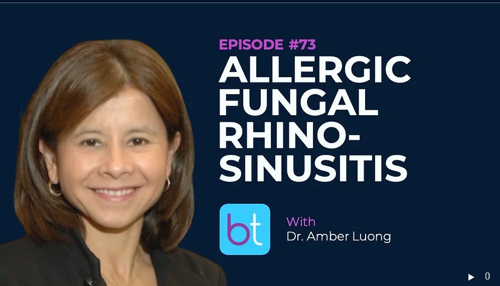 Thanks <a href="/_backtableENT/">BackTable ENT</a> for the opportunity to talk about my favorite rhinologic subject...allergic fungal rhinosinusitis.  <a href="/gopibshah/">Gopi Shah MD</a> @AshleyAgan are amazing hosts!

backtable.com/shows/ent/podc…
