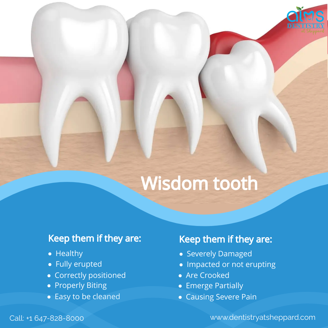 aims_sheppard's tweet photo. Erupting wisdom teeth can grow at various angles in the jaw, sometimes even horizontally, and thus cause severe pain to the adjoining tooth. The decision to remove wisdom teeth isn’t always straightforward.
 
Get a consultation today. 

#AIMS #aimsdentistrysheppard #wisdomteeth https://t.co/DrmyoFpnfA
