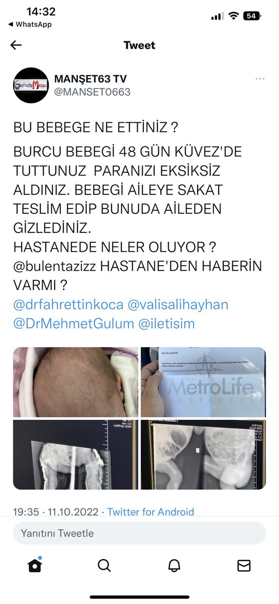 salihpal63's tweet photo. Sayın valim sayın sağlık il müdürüm siz bu özel hastaneye ne zaman el atacaksınız başka aileler de acı çektikten sonra mı benim çocuğumun kırdıkları ayağın hesabı kalmaz @valisalihayhan @drfahrettinkoca @bulentazizz @AjansUrfa @UGUR_BUDAK https://t.co/fEWK6HawaM