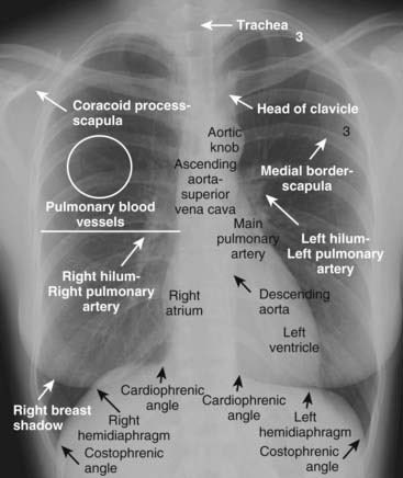 #Imaging #chestxray