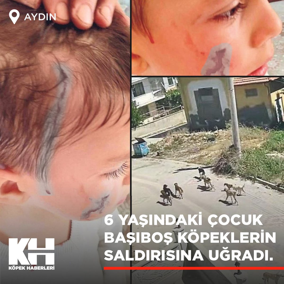 Aydın'ın Söke ilçesi Konak Mahallesi'nde markete gitmek için abisi Mustafa Başay (9) ile birlikte yolda yürüyen 6 yaşındaki Keremcan Başay, başıboş köpeklerin saldırısına uğradı. Mahalle sakinlerinin kurtardığı küçük çocuk, yüzünden ve kafasından yaralandı.