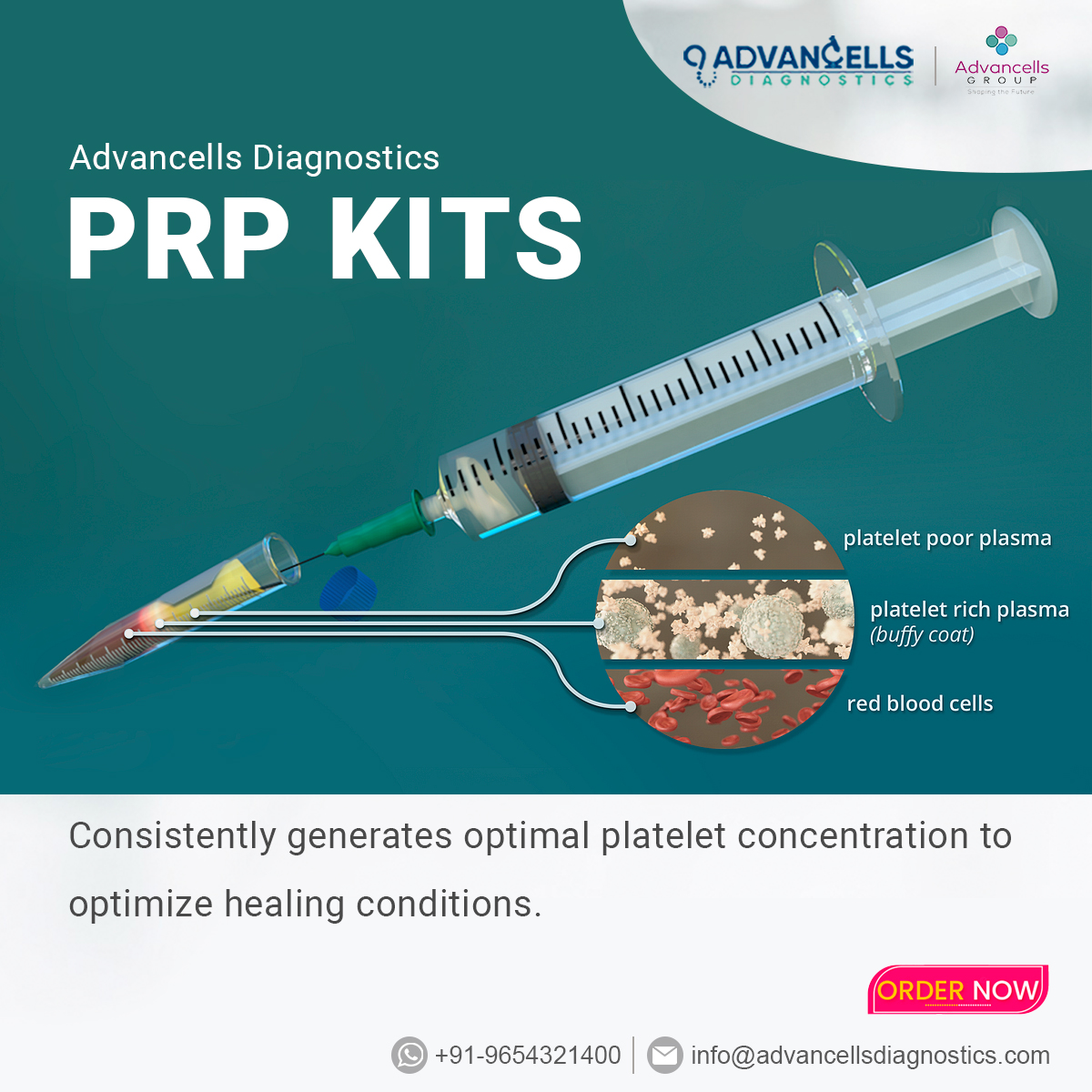 AdvancellDiagno's tweet photo. Advancells Diagnostics PRP Kit guarantees you easy and validated high-yield platelets isolation for PRP therapy.
Connect with us at info@advancellsdiagnostics.com to place an order.
#prp #prptherapy #prptreatment #prpkit #advancells #healthcare #antiagin #haircare #skincare https://t.co/nDNBTrkQIG